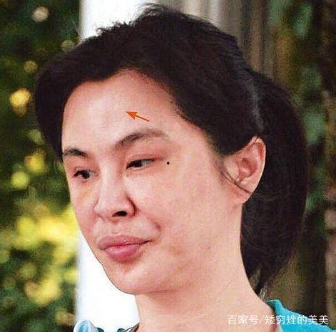 孙艺洲整容前后照片,颜值蜕变之路