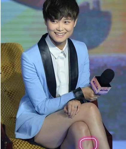 腿上有疤的明星,揭秘腿上有疤的明星